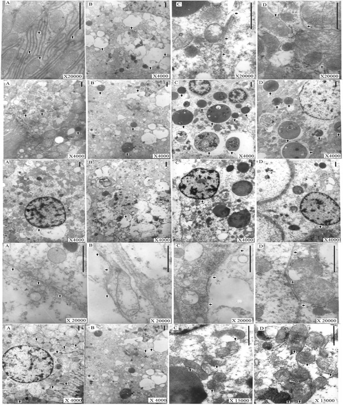 海洋所研究发现红球藻虾青素保护作用溶酶体自噬新途径